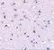Nanos C2HC-Type Zinc Finger 1 antibody, A07276, Boster Biological Technology, Immunohistochemistry frozen image 