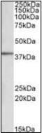 Protein kinase C delta-binding protein antibody, orb137621, Biorbyt, Western Blot image 