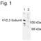 Potassium Voltage-Gated Channel Subfamily B Member 2 antibody, PA1-4666, Invitrogen Antibodies, Western Blot image 