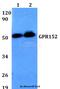 G Protein-Coupled Receptor 152 antibody, A16638-1, Boster Biological Technology, Western Blot image 
