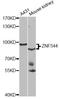 Zinc Finger Protein 544 antibody, A7366, ABclonal Technology, Western Blot image 
