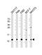 LSM2 Homolog, U6 Small Nuclear RNA And MRNA Degradation Associated antibody, M07586, Boster Biological Technology, Western Blot image 