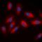 ATP Citrate Lyase antibody, orb393195, Biorbyt, Immunofluorescence image 