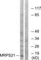 Mitochondrial Ribosomal Protein S21 antibody, GTX87804, GeneTex, Western Blot image 