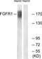 Fibroblast Growth Factor Receptor 1 antibody, TA312417, Origene, Western Blot image 