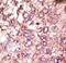 Autophagy Related 4C Cysteine Peptidase antibody, LS-C156599, Lifespan Biosciences, Immunohistochemistry paraffin image 