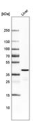 Ornithine Carbamoyltransferase antibody, AMAb91266, Atlas Antibodies, Western Blot image 