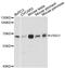 V-Set And Immunoglobulin Domain Containing 1 antibody, A13875, ABclonal Technology, Western Blot image 