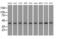 Sterol O-acyltransferase 2 antibody, MA5-25116, Invitrogen Antibodies, Western Blot image 