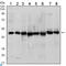 Hedgehog Interacting Protein antibody, LS-C812642, Lifespan Biosciences, Western Blot image 
