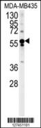 Rho Guanine Nucleotide Exchange Factor 3 antibody, 62-060, ProSci, Western Blot image 