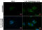 Sequestosome 1 antibody, GTX100685, GeneTex, Immunofluorescence image 