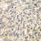 Tousled Like Kinase 2 antibody, 22-473, ProSci, Immunohistochemistry paraffin image 