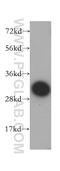 Carbonic anhydrase 3 antibody, 15197-1-AP, Proteintech Group, Western Blot image 