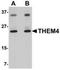 Thioesterase Superfamily Member 4 antibody, NBP1-77360, Novus Biologicals, Western Blot image 