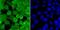 DNA (cytosine-5)-methyltransferase 3B antibody, NBP2-80402, Novus Biologicals, Immunofluorescence image 