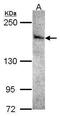 Serine/Threonine Kinase 36 antibody, PA5-28897, Invitrogen Antibodies, Western Blot image 