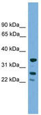 H1 Histone Family Member O Oocyte Specific antibody, TA337814, Origene, Western Blot image 