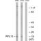 Ribosomal Protein L15 antibody, A07136, Boster Biological Technology, Western Blot image 
