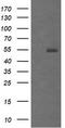 Protein Mdm4 antibody, TA505733S, Origene, Western Blot image 