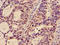 Glucosaminyl (N-Acetyl) Transferase 3, Mucin Type antibody, orb400456, Biorbyt, Immunohistochemistry paraffin image 