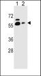 Svct1 antibody, PA5-48431, Invitrogen Antibodies, Western Blot image 