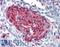 S100 Calcium Binding Protein A4 antibody, LS-B2381, Lifespan Biosciences, Immunohistochemistry paraffin image 