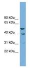 RNA Binding Fox-1 Homolog 1 antibody, GTX17554, GeneTex, Western Blot image 