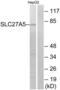 Bile acyl-CoA synthetase antibody, LS-C119783, Lifespan Biosciences, Western Blot image 