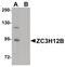 Zinc Finger CCCH-Type Containing 12B antibody, PA5-20927, Invitrogen Antibodies, Western Blot image 