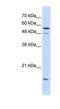 Karyopherin Subunit Alpha 2 antibody, NBP1-58067, Novus Biologicals, Western Blot image 