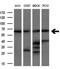Leukotriene A4 Hydrolase antibody, GTX84173, GeneTex, Western Blot image 
