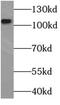 Complement C3 antibody, FNab01102, FineTest, Western Blot image 