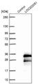 Spermatogenesis Associated 24 antibody, NBP1-92429, Novus Biologicals, Western Blot image 