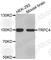 Transient Receptor Potential Cation Channel Subfamily C Member 4 antibody, A3337, ABclonal Technology, Western Blot image 