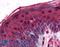 TPX2 Microtubule Nucleation Factor antibody, LS-B146, Lifespan Biosciences, Immunohistochemistry paraffin image 