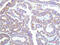 Signal Transducer And Activator Of Transcription 1 antibody, GTX34232, GeneTex, Immunohistochemistry paraffin image 