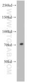 E3 ubiquitin-protein ligase TRIM41 antibody, 18468-1-AP, Proteintech Group, Western Blot image 