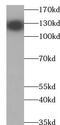Zinc Finger And BTB Domain Containing 38 antibody, FNab09593, FineTest, Western Blot image 