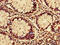 Arginyl-TRNA Synthetase antibody, CSB-PA019344LA01HU, Cusabio, Immunohistochemistry frozen image 