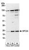 Kinetochore protein Spc24 antibody, A304-260A, Bethyl Labs, Western Blot image 