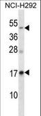 Receptor activity-modifying protein 3 antibody, LS-C162425, Lifespan Biosciences, Western Blot image 