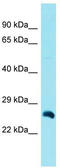LDL Receptor Related Protein 5 Like antibody, TA337415, Origene, Western Blot image 