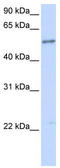 Interleukin 1 Receptor Like 1 antibody, TA342005, Origene, Western Blot image 