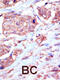EPHB6 antibody, 63-065, ProSci, Immunohistochemistry paraffin image 
