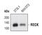 Reversion Inducing Cysteine Rich Protein With Kazal Motifs antibody, MA5-14781, Invitrogen Antibodies, Western Blot image 