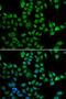 Laminin Subunit Beta 2 antibody, LS-C334748, Lifespan Biosciences, Immunofluorescence image 