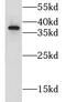 Glyoxylate reductase/hydroxypyruvate reductase antibody, FNab03645, FineTest, Western Blot image 