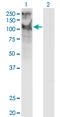 Transient Receptor Potential Cation Channel Subfamily C Member 5 antibody, LS-C198371, Lifespan Biosciences, Western Blot image 