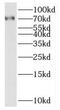 Sterile alpha motif domain-containing protein 11 antibody, FNab07586, FineTest, Western Blot image 